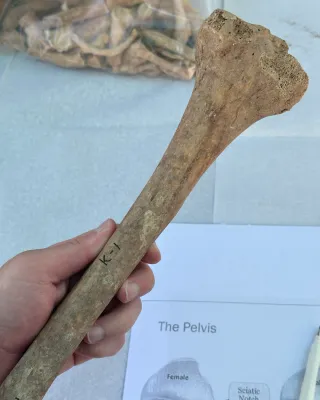 tibia bone 